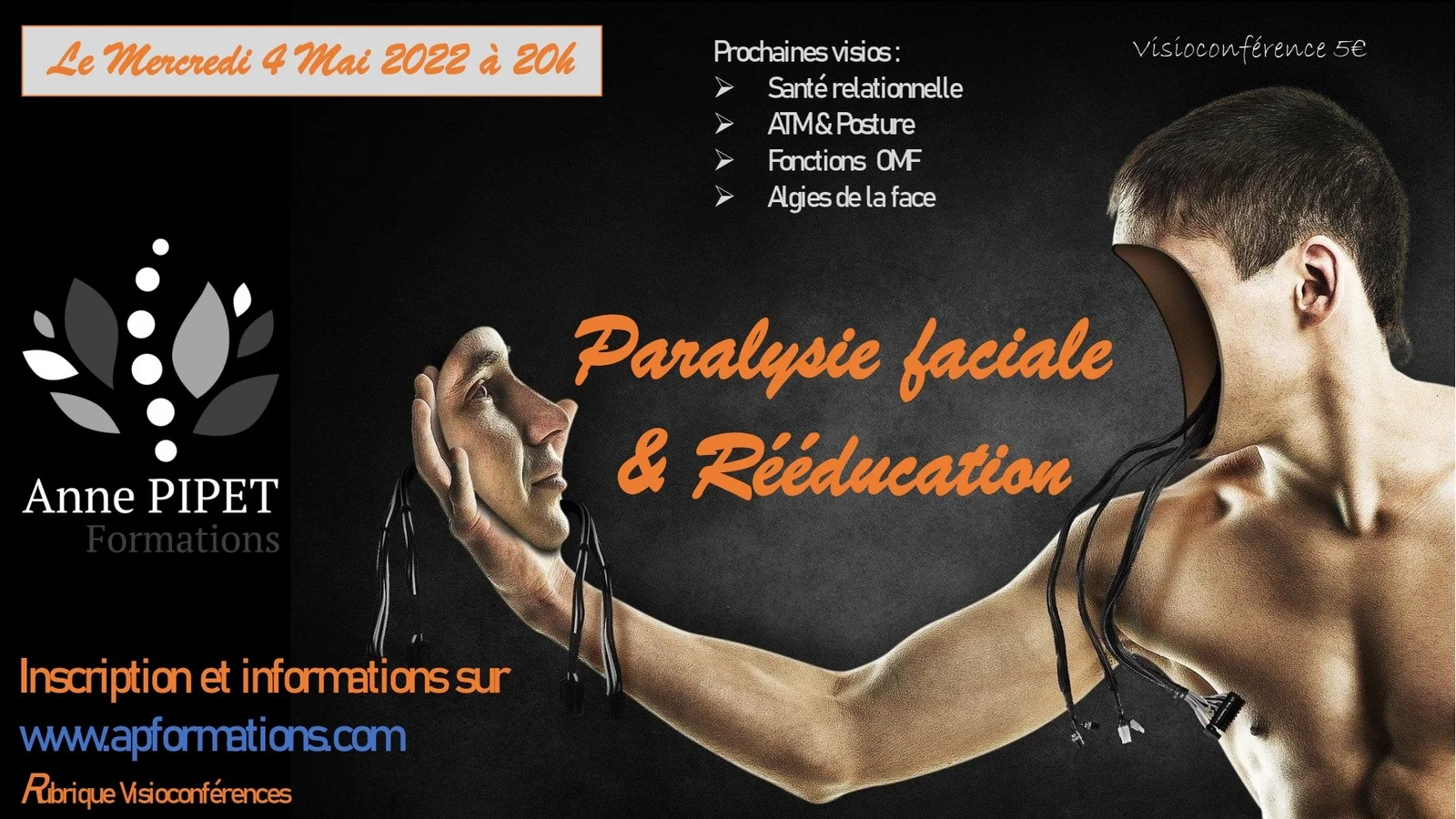 Visioconférence Paralysie Faciale périphérique le 04 Mai 2022