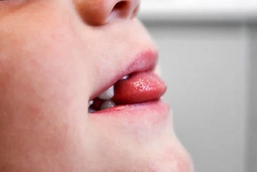 Formation et échanges autour d'exercice de rééducation maxillo-faciale dans le cadre de la pris en charge des fonctions maxillo-faciales dans le cadre des traitements orthodontiques destinée aux kinésithérapeutes et orthophonistes